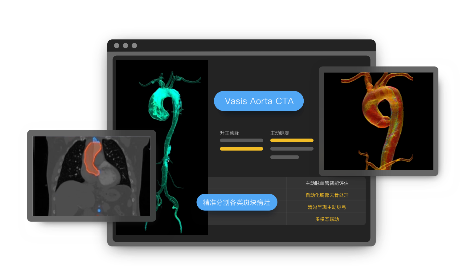 Vasis Aorta CTA 主动脉血管智能评估系统